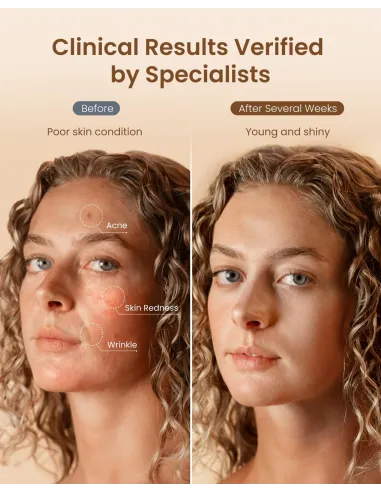Máscara LED Renpho Artemis Blush 4 luces NIR facial