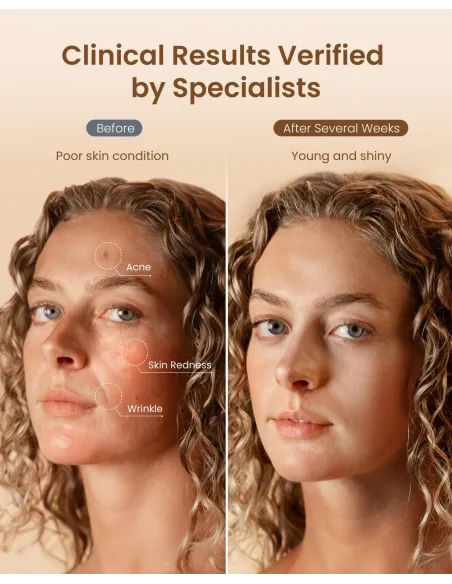 Máscara LED Renpho Artemis Blush 4 luces NIR facial